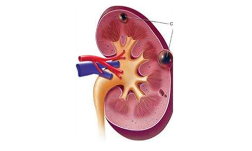 什么叫单纯性囊肿 201961982946178.jpg